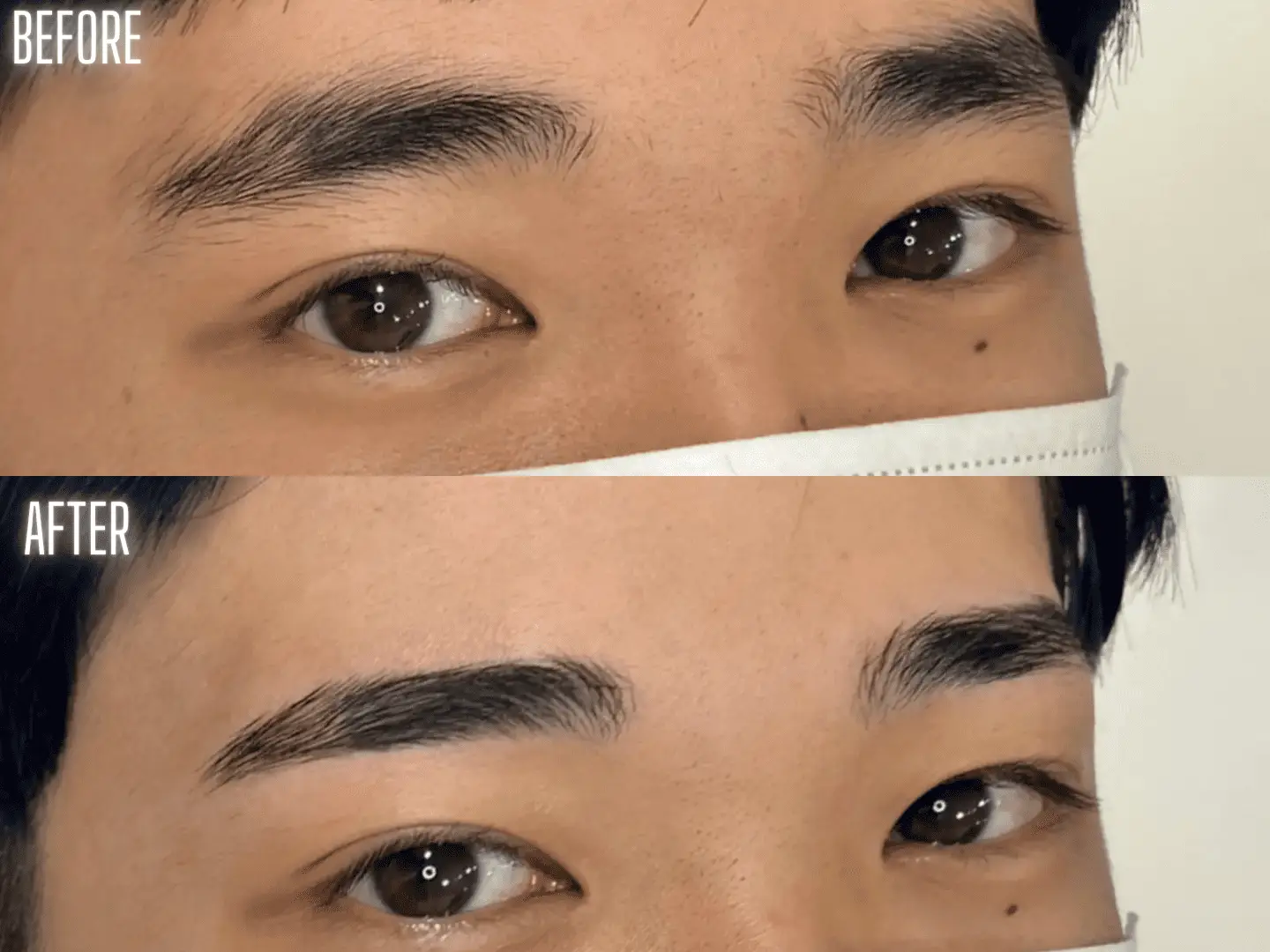 ビフォアアフター写真