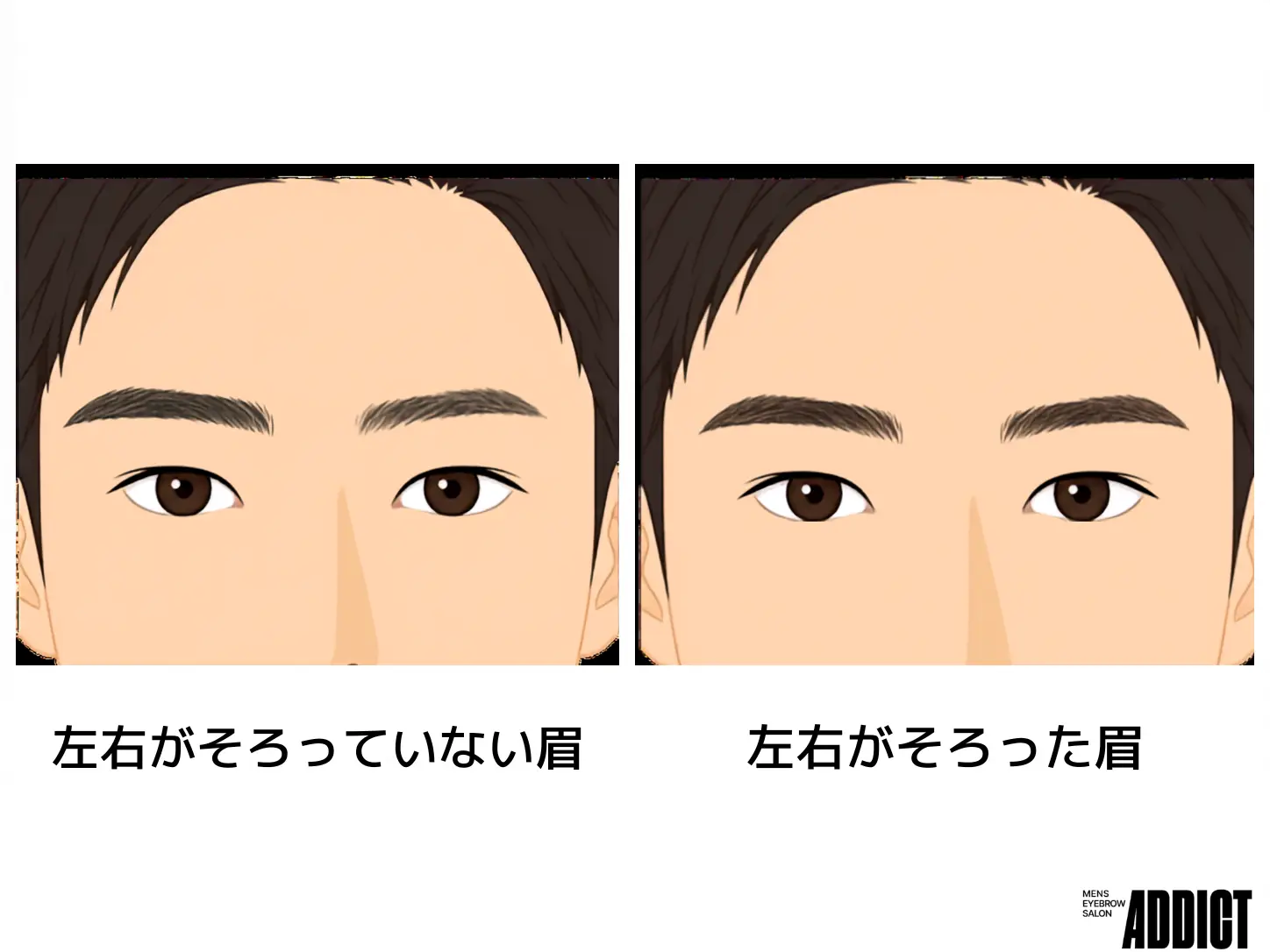 眉毛が左右非対称になる