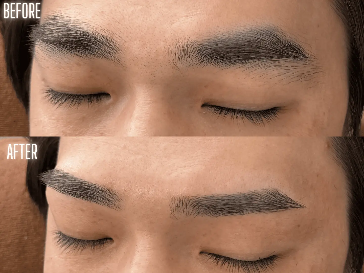 ビフォアアフター写真