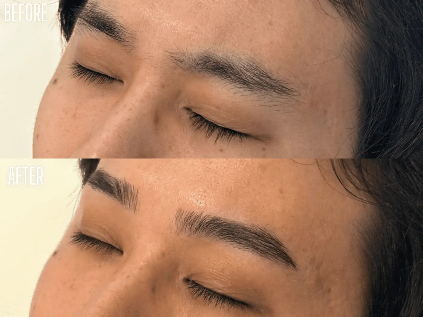 ビフォアアフター写真